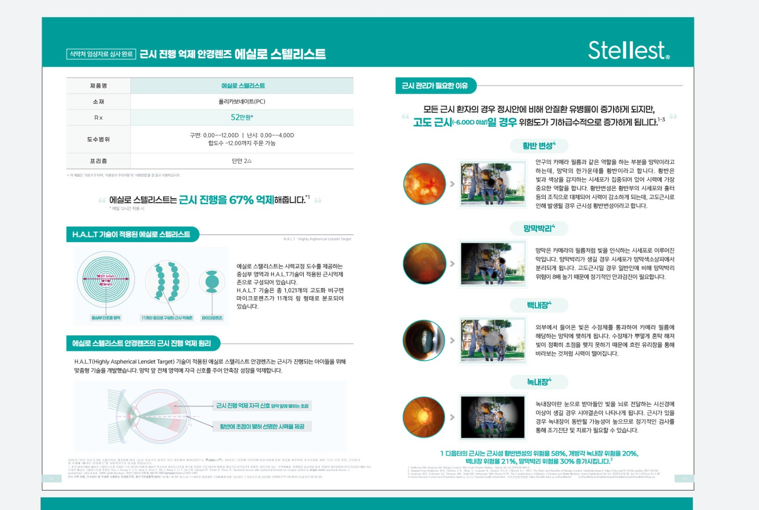 Essilor Stellest 스텔리스트